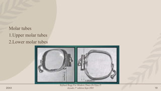 20XX
Refined Begg For Modern Times.Dr.Vijay P.
Jayade.1st edition.Sept.2001 19
Molar tubes
1.Upper molar tubes
2.Lower molar tubes
 