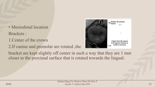 20XX
Refined Begg For Modern Times.Dr.Vijay P.
Jayade.1st edition.Sept.2001 21
• Mesiodistal location
Brackets :
1.Center of the crown
2.If canine and premolar are rotated ,the
bracket are kept slightly off center in such a way that they are 1 mm
closer to the proximal surface that is rotated towards the lingual.
 