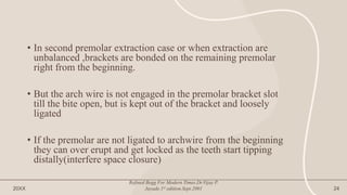 • In second premolar extraction case or when extraction are
unbalanced ,brackets are bonded on the remaining premolar
right from the beginning.
• But the arch wire is not engaged in the premolar bracket slot
till the bite open, but is kept out of the bracket and loosely
ligated
• If the premolar are not ligated to archwire from the beginning
they can over erupt and get locked as the teeth start tipping
distally(interfere space closure)
20XX
Refined Begg For Modern Times.Dr.Vijay P.
Jayade.1st edition.Sept.2001 24
 