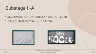 Substage I -A
• ALIGNMENT OF CROWDED ANTERIOR TEETH
• Initially-Multiloop wire: 0.016 S.S wire
20XX
Refined Begg For Modern Times.Dr.Vijay P.
Jayade.1st edition.Sept.2001 39
 