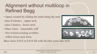 Alignment without multiloop in
Refined Begg
• Space created by sliding the teeth along the arch.
class II elastics – upper arch.
class I elastics - lower arch.
• Base wires – reasonably stiff
- Not worsen existing overbite.
- Affect lower arch form.
Base wires 0.016 or 0.014 SS with flexible wires like NiTi
20XX
Refined Begg For Modern Times.Dr.Vijay P.
Jayade.1st edition.Sept.2001 41
 