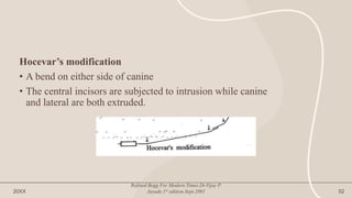 Hocevar’s modification
• A bend on either side of canine
• The central incisors are subjected to intrusion while canine
and lateral are both extruded.
20XX
Refined Begg For Modern Times.Dr.Vijay P.
Jayade.1st edition.Sept.2001 52
 