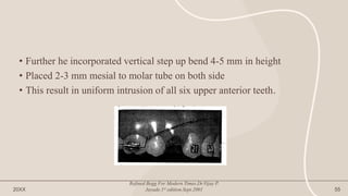 • Further he incorporated vertical step up bend 4-5 mm in height
• Placed 2-3 mm mesial to molar tube on both side
• This result in uniform intrusion of all six upper anterior teeth.
20XX
Refined Begg For Modern Times.Dr.Vijay P.
Jayade.1st edition.Sept.2001 55
 