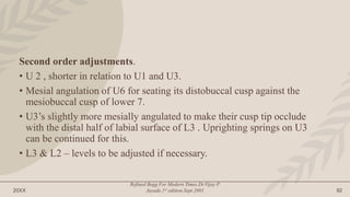 20XX
Refined Begg For Modern Times.Dr.Vijay P.
Jayade.1st edition.Sept.2001 92
Second order adjustments.
• U 2 , shorter in relation to U1 and U3.
• Mesial angulation of U6 for seating its distobuccal cusp against the
mesiobuccal cusp of lower 7.
• U3’s slightly more mesially angulated to make their cusp tip occlude
with the distal half of labial surface of L3 . Uprighting springs on U3
can be continued for this.
• L3 & L2 – levels to be adjusted if necessary.
 