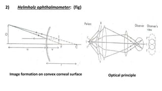 2) Helmholz ophthalmometer: (fig)
Image formation on convex corneal surface Optical principle
 