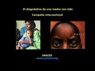 El diagnóstico de una madre con sida Campaña internacional  UNICEF www.unicef.org 