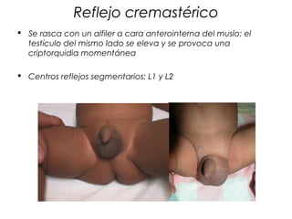 Reflejo cremastérico
 Se rasca con un alfiler a cara anterointerna del muslo; el
  testículo del mismo lado se eleva y se provoca una
  criptorquidia momentánea

 Centros reflejos segmentarios: L1 y L2
 