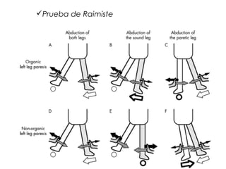 Prueba de Raimiste
 