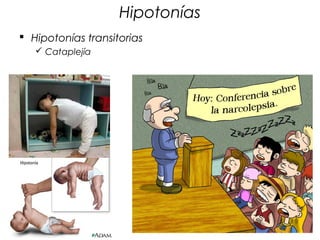 Hipotonías
 Hipotonías transitorias
    Cataplejía
 