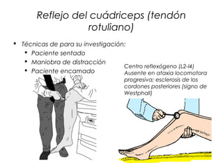 Reflejo del cuádriceps (tendón
                   rotuliano)
 Técnicas de para su investigación:
    Paciente sentado
    Maniobra de distracción
                                   Centro reflexógeno (L2-l4)
    Paciente encamado             Ausente en ataxia locomotora
                                    progresiva; esclerosis de los
                                    cordones posteriores (signo de
                                    Westphall)
 