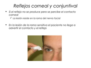 Reflejos corneal y conjuntival
 Si el reflejo no se produce pero se percibe el contacto
  corneal
    La lesión reside en la rama del nervio facial


 En la lesión de la rama sensitiva el paciente no llega a
  advertir el contacto y el reflejo
 