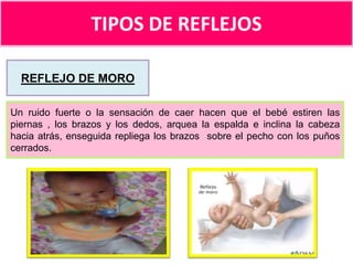 TIPOS DE REFLEJOS
REFLEJO DE MORO
Un ruido fuerte o la sensación de caer hacen que el bebé estiren las
piernas , los brazos y los dedos, arquea la espalda e inclina la cabeza
hacia atrás, enseguida repliega los brazos sobre el pecho con los puños
cerrados.

 