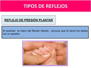 TIPOS DE REFLEJOS
REFLEJO DE PRESIÓN PLANTAR

Al acariciar la mano del Recién Nacido , provoca que él cierre los dedos
con un apretón.

 