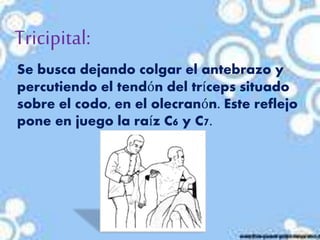 Tricipital:
Se busca dejando colgar el antebrazo y
percutiendo el tendón del tríceps situado
sobre el codo, en el olecranón. Este reflejo
pone en juego la raíz C6 y C7.
 