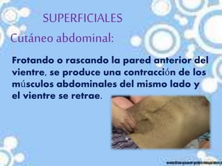 SUPERFICIALES
Cutáneo abdominal:
Frotando o rascando la pared anterior del
vientre, se produce una contracción de los
músculos abdominales del mismo lado y
el vientre se retrae.
 