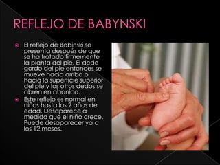    El reflejo de Babinski se
    presenta después de que
    se ha frotado firmemente
    la planta del pie. El dedo
    gordo del pie entonces se
    mueve hacia arriba o
    hacia la superficie superior
    del pie y los otros dedos se
    abren en abanico.
   Este reflejo es normal en
    niños hasta los 2 años de
    edad. Desaparece a
    medida que el niño crece.
    Puede desaparecer ya a
    los 12 meses.
 