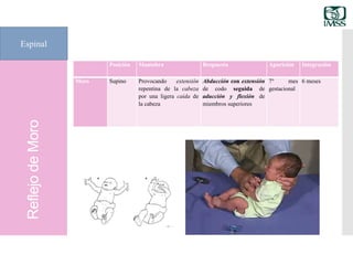 ReflejodeMoro
Espinal
Posición Maniobra Respuesta Aparición Integración
Moro Supino Provocando extensión
repentina de la cabeza
por una ligera caída de
la cabeza
Abducción con extensión
de codo seguida de
aducción y flexión de
miembros superiores
7° mes
gestacional
6 meses
 