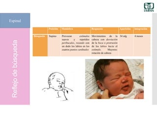 Reflejodebúsqueda
Espinal
Posición Maniobra Respuesta Aparición Integración
Búsqueda Supino Provocan estímulos
suaves y repetidos
peribucales, rozando con
un dedo los labios en los
cuatros puntos cardinales
Movimientos de la
cabeza con desviación
de la boca o protrusión
de los labios hacia el
estímulo. Mayores:
rotación de cabeza
34 sdg 4 meses
 