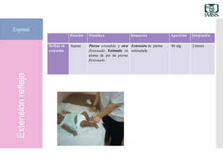 Extensiónrefleja
Espinal
Posición Maniobra Respuesta Aparición Integración
Reflejo de
extensión
Supina Pierna extendida y otra
flexionada. Estímulo en
planta de pie de pierna
flexionada
Extensión de pierna
estimulada
40 sdg 2 meses
 