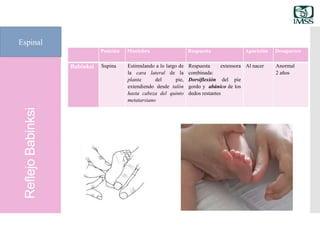 ReflejoBabinksi
Espinal
Posición Maniobra Respuesta Aparición Desaparece
Babinksi Supina Estimulando a lo largo de
la cara lateral de la
planta del pie,
extendiendo desde talón
hasta cabeza del quinto
metatarsiano
Respuesta extensora
combinada:
Dorsiflexión del pie
gordo y abánico de los
dedos restantes
Al nacer Anormal
2 años
 