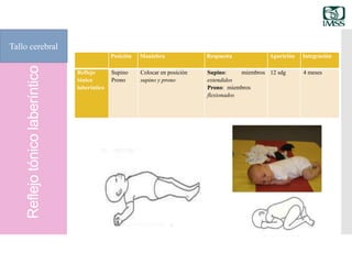 Reflejotónicolaberíntico
Tallo cerebral
Posición Maniobra Respuesta Aparición Integración
Reflejo
tónico
laberíntico
Supino
Prono
Colocar en posición
supino y prono
Supino: miembros
extendidos
Prono: miembros
flexionados
12 sdg 4 meses
 