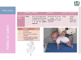ReflejodeGalant
Tallo cerebral
Posición Maniobra Respuesta Aparición Integración
Reflejo de
Galant
Prono Rozar, con el dedo índice,
la espalda del bebé desde
el hombro hacia nalgas, 2
a 3 cm de apófisis
espinosas
Incurvación del tronco
y cabeza, con la
concavidad en el lado
estimulado
24 sdg 4 meses
Puede
desaparecer
hasta el año
 
