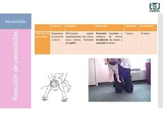 Reaccióndeparacaídas
Mesencéfalo
Posición Maniobra Respuesta Aparición Integración
Reacción de
paracaídas
Suspensión
en posición
vertical
Movimiento amplio
repentinamente con cabeza
hacia delante. Sostenido
por pelvis
Extensión inmediata y
simétrica de brazos,
dorsiflexión de manos y
extensión de dedos
7 meses 10 meses
 