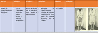 REFLEJO POSICIÓN ESTIMULO RESPUESTA APARECE DESAPARECE
Reflejo de
enderezamiento
del cuello.
• Px DS
• Cabeza en
posición
media,
brazos y
piernas
extendidos
Rotar la cabeza
del px hacia un
lado activa o
pasivamente
• Negativa: el
cuerpo no rota.
• Positiva: el cuerpo
rota como un todo
hacia la misma
dirección de la
cabeza.
0-6 meses
 