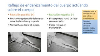 Reflejo de enderezamiento del cuerpo actúando
sobre el cuerpo
• Reacción positiva (+)
• Rotación segmentaria del cuerpo
entre los hombros y la pelvis.
• Normal hasta los 6-18 meses.
• Reacción negativa (-)
• El cuerpo rota hacía un lado
como un todo.
• Indica retraso en
maduración.
Estímulo: rotar la
cabeza hacía un
lado activa o
negativamente
Posición:
Decúbito s.
cabeza en
posición media,
brazos y piernas
en extensión
 