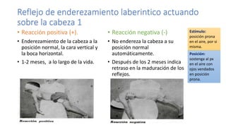 Reflejo de enderezamiento laberintico actuando
sobre la cabeza 1
• Reacción positiva (+).
• Enderezamiento de la cabeza a la
posición normal, la cara vertical y
la boca horizontal.
• 1-2 meses, a lo largo de la vida.
• Reacción negativa (-)
• No endereza la cabeza a su
posición normal
automáticamente.
• Después de los 2 meses indica
retraso en la maduración de los
reflejos.
Estímulo:
posición prona
en el aire, por si
misma.
Posición:
sostenga al px
en el aire con
ojos vendados
en posición
prona.
 