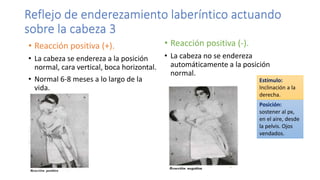 Reflejo de enderezamiento laberíntico actuando
sobre la cabeza 3
• Reacción positiva (+).
• La cabeza se endereza a la posición
normal, cara vertical, boca horizontal.
• Normal 6-8 meses a lo largo de la
vida.
• Reacción positiva (-).
• La cabeza no se endereza
automáticamente a la posición
normal.
Posición:
sostener al px,
en el aire, desde
la pelvis. Ojos
vendados.
Estímulo:
Inclinación a la
derecha.
 