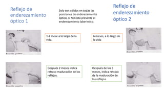 Reflejo de
enderezamiento
óptico 1
Reflejo de
enderezamiento
óptico 2
Solo son válidas en todas las
posiciones de enderezamiento
óptico, si NO está presente el
enderezamiento laberintico.
1-2 mese a lo largo de la
vida.
Después 2 meses indica
retraso maduración de los
reflejos.
6 meses, a lo largo de
la vida
Después de los 6
meses, indica retraso
de la maduración de
los reflejos.
 