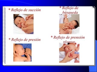 * Reflejo de
* Reflejo de succión
                              búsqueda




                       * Reflejo de prensión
* Reflejo de presión
                               plantar
 