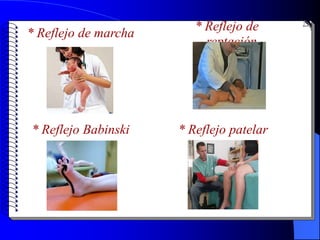 * Reflejo de
* Reflejo de marcha
                           reptación




* Reflejo Babinski    * Reflejo patelar
 