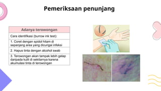 Refleksi_kasus_scabies[1] .pptx