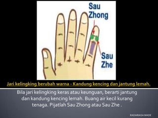 Bila jari kelingking keras atau keunguan, berarti jantung
  dan kandung kencing lemah. Buang air kecil kurang
        tenaga. Pijatlah Sau Zhong atau Sau Zhe .
                                                     RADARIASA MADE
 
