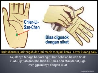 Gejalanya tenaga berkurang, tubuh sebelah bawah tidak
kuat. Pijatlah daerah Chien-Li-San-Chen atau dapat juga
               menggosoknya dengan sikat
                                                   RADARIASA MADE
 