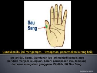 Ibu jari Sau Sang . Gundukan ibu jari menjadi kempis atau
berubah menjadi keunguan, berarti pernapasan atau lambung
    dan usus mengalami gangguan. Pijatlah titik Sau Sang.

                                                      RADARIASA MADE
 