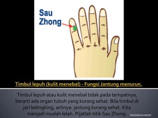 Timbul lepuh atau kulit menebal tidak pada tempatnya,
berarti ada organ tubuh yang kurang sehat. Bila timbul di
   jari kelingking, artinya: jantung kurang sehat. Kita
     menjadi mudah lelah. Pijatlah titik Sau Zhong. RADARIASA MADE
 