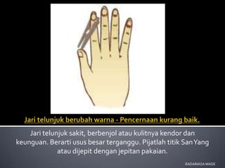 Jari telunjuk sakit, berbenjol atau kulitnya kendor dan
keunguan. Berarti usus besar terganggu. Pijatlah titik San Yang
              atau dijepit dengan jepitan pakaian.
                                                       RADARIASA MADE
 