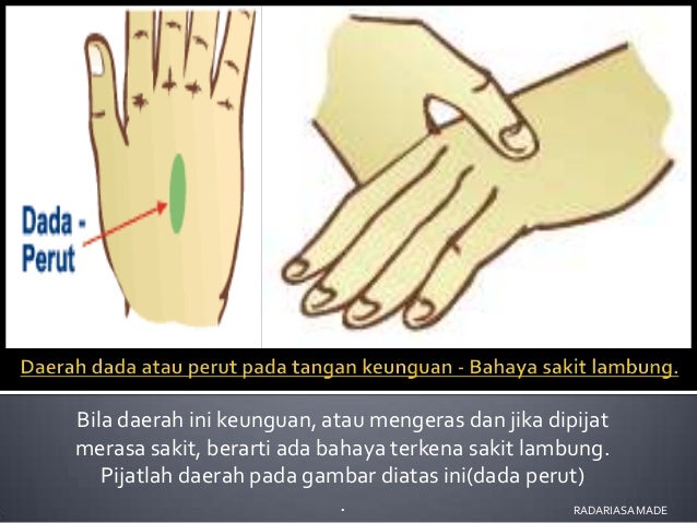 Refleksi Telapak Tangan
