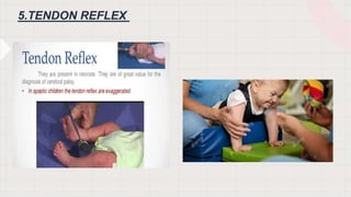 5.TENDON REFLEX
 
