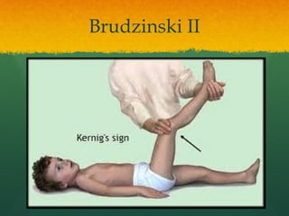 Comprehensive Overview of Meningeal Signs and Reflexes in Neurology | PPTX