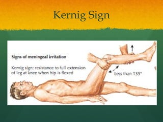 Comprehensive Overview of Meningeal Signs and Reflexes in Neurology | PPTX