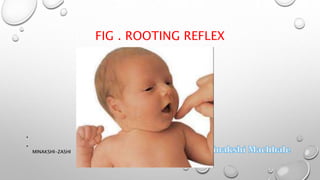 Reflex and reaction maturation | PPTX