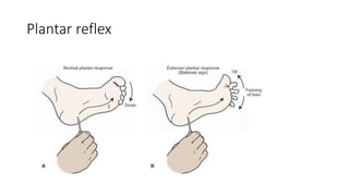 Plantar reflex
 