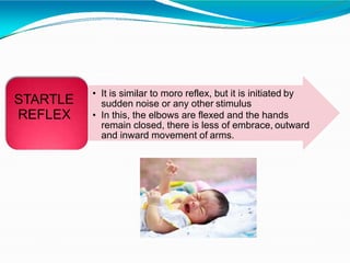 • It is similar to moro reflex, but it is initiated by
sudden noise or any other stimulus
• In this, the elbows are flexed and the hands
remain closed, there is less of embrace, outward
and inward movement of arms.
STARTLE
REFLEX
 