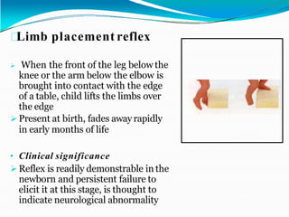 Limb placement reflex
 When the front of the leg below the
knee or the arm below the elbow is
brought into contact with the edge
of a table, child lifts the limbs over
the edge
 Present at birth, fades awayrapidly
in early months of life
• Clinical significance
 Reflex is readily demonstrable in the
newborn and persistent failure to
elicit it at this stage, is thought to
indicate neurological abnormality
 