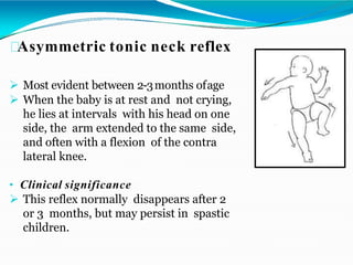 Asymmetric tonic neck reflex
 Most evident between 2-3months ofage
 When the baby is at rest and not crying,
he lies at intervals with his head on one
side, the arm extended to the same side,
and often with a flexion of the contra
lateral knee.
• Clinical significance
 This reflex normally disappears after 2
or 3 months, but may persist in spastic
children.
 
