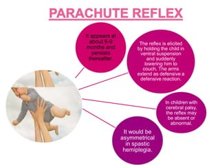 It appears at
about 6-9
months and
persists
thereafter.
The reflex is elicited
by holding the child in
ventral suspension
and suddenly
lowering him to
couch. The arms
extend as defensive a
defensive reaction.
In children with
cerebral palsy,
the reflex may
be absent or
abnormal.
It would be
asymmetrical
in spastic
hemiplegia.
 